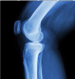 Knee joint diagnosis before treatment