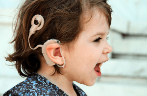 Cochlear-Implants-300x196