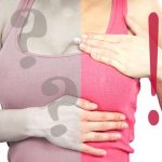 Breast cancer myth
