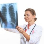 lung cancer