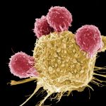 CAR-T therapy in Israel (kymriah)