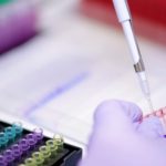 Melanoma Immunotherapy in Israel
