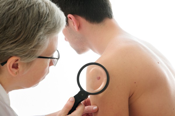 Skin cancer treatment at leading Israeli onco-dermatologists