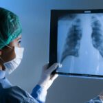 The leading surgeon in Israel