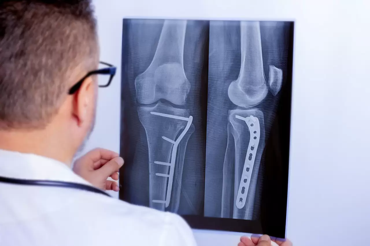 Orthopedic oncologists in Israel 