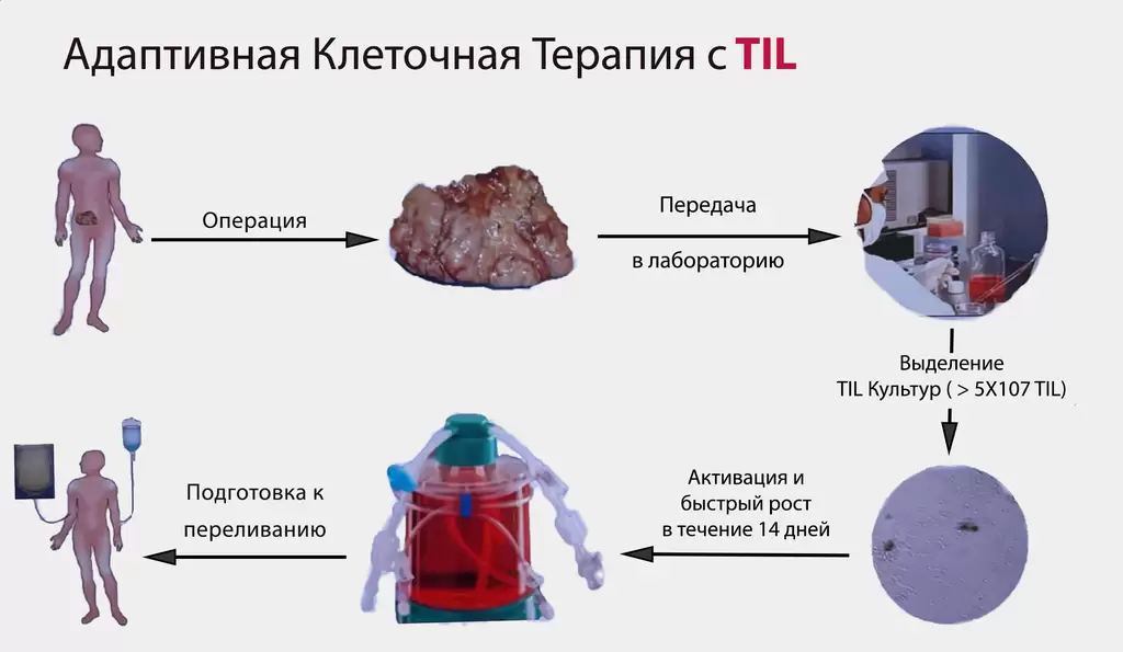 Лечение TIL в Израиле - консультация врача онлайн